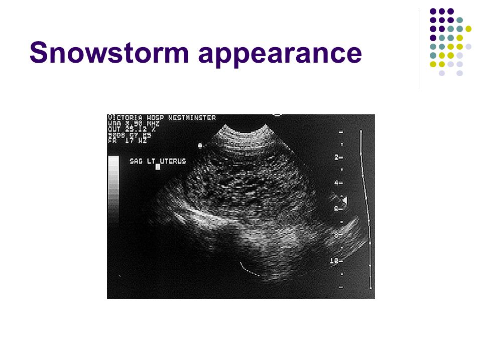 pregnancy ultrasound dating